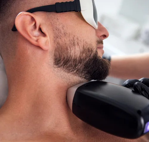 Erkekler İçin Lazer Epilasyon: Bakımlı ve Konforlu Bir Yaşam